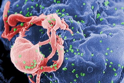 美國HIV帶原者 多數感染3年不自知
