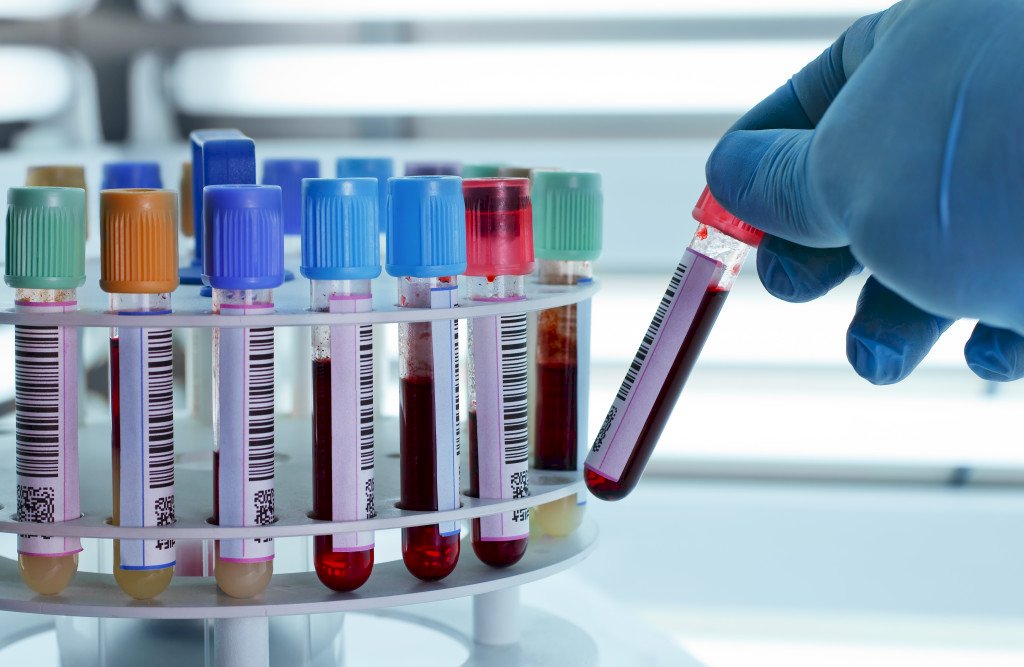 全球首創 澳科學家以血液檢測黑色素瘤