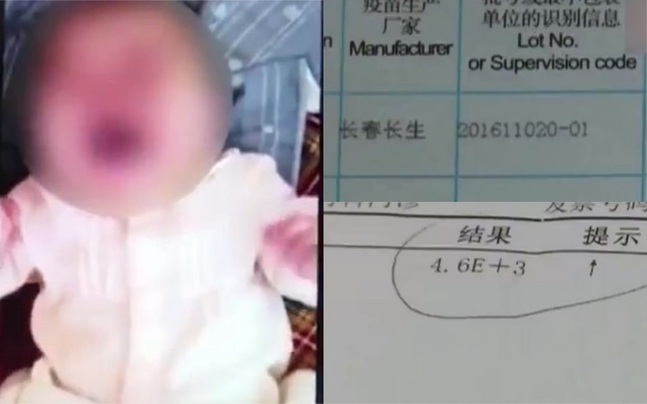 深圳女嬰接種長生非問題疫苗 反罹患百日咳