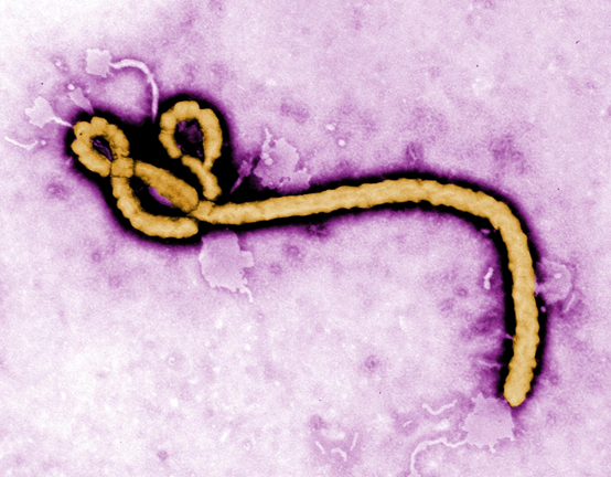 科學家發現抗體 能對抗3種伊波拉病毒