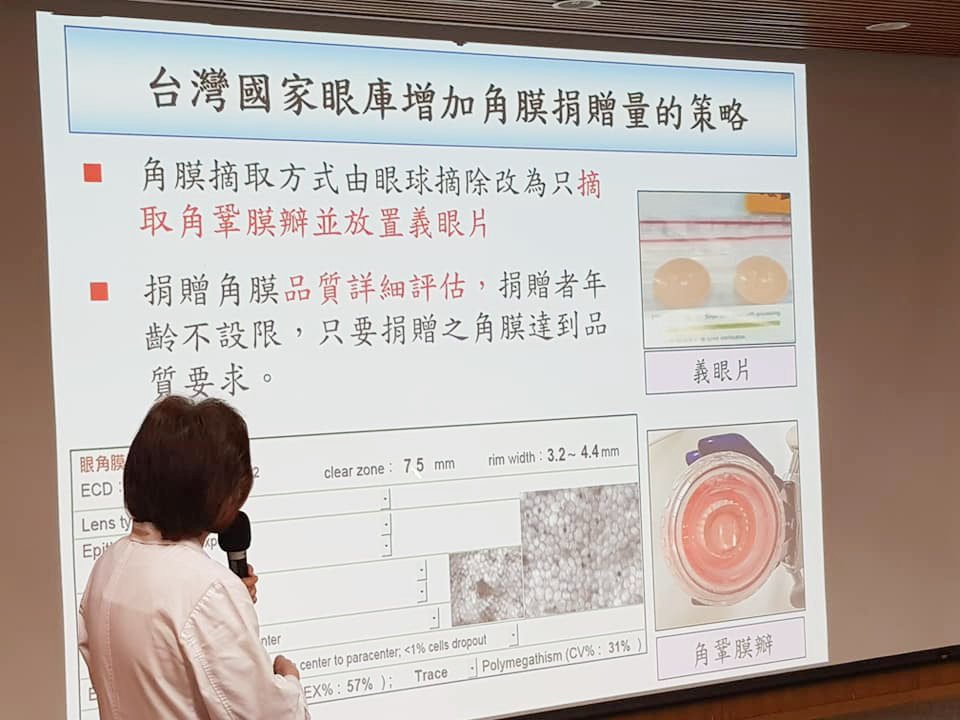 菌血症患者也可捐角膜 台灣國家眼庫改寫國際思維
