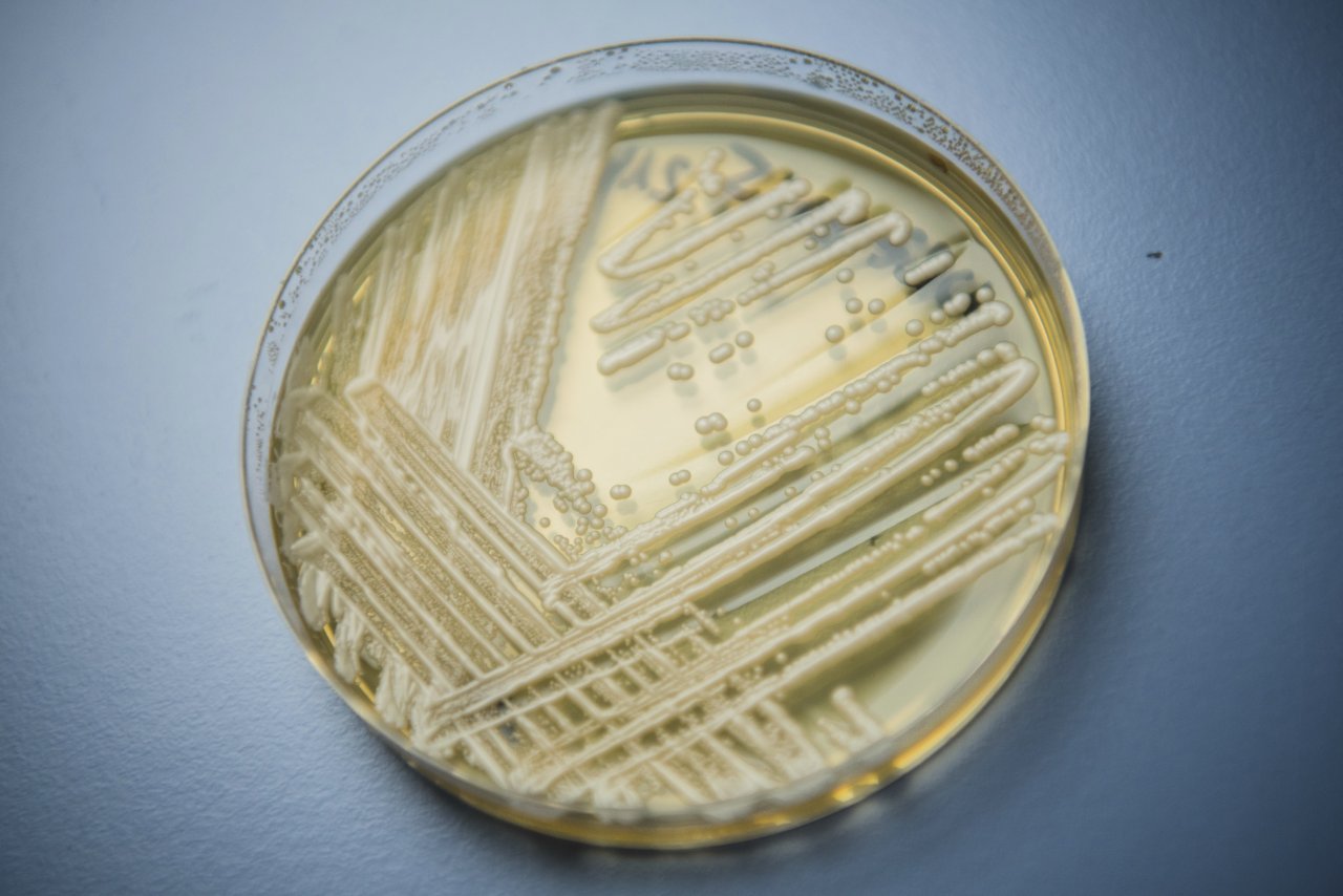 超級細菌攻入中國 最少18人確診