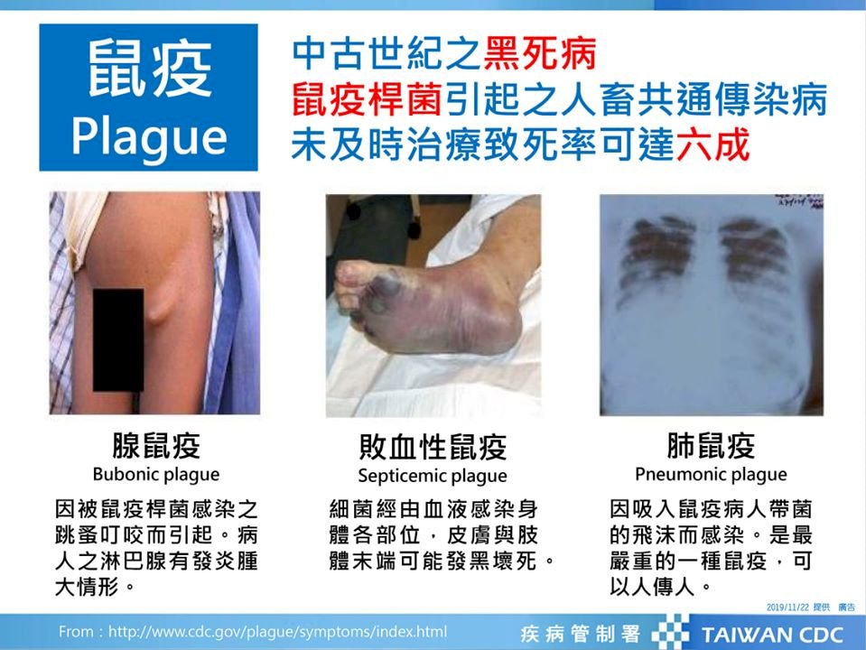 中國大陸27日深夜新增腺鼠疫個案 疾管署密切掌握