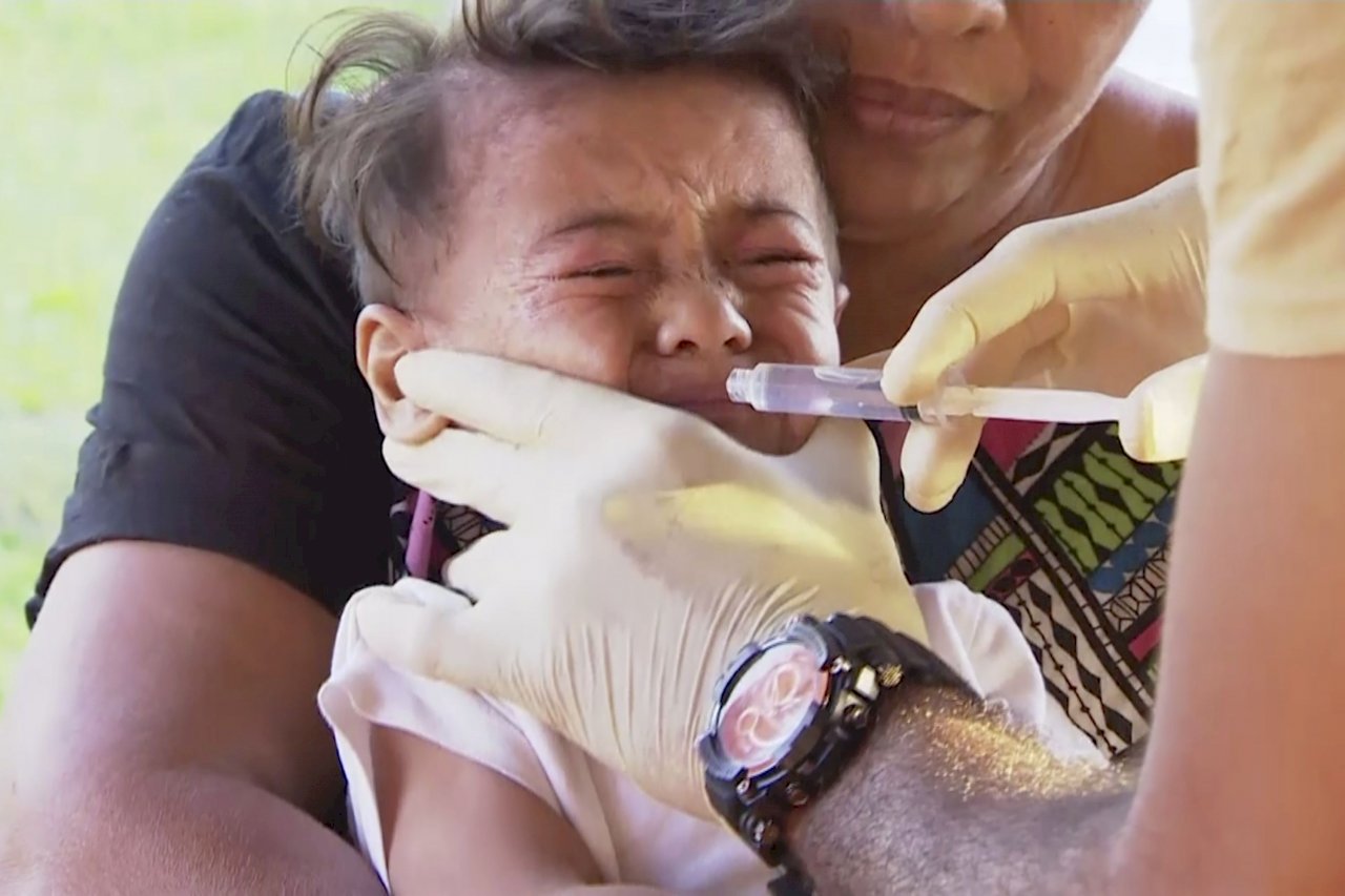 薩摩亞麻疹疫情接近高峰 33死多為兒童