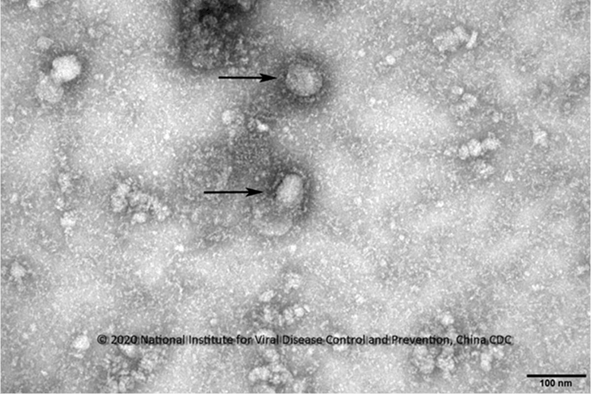 中東首例新型冠狀病毒病例 來自武漢一家4口