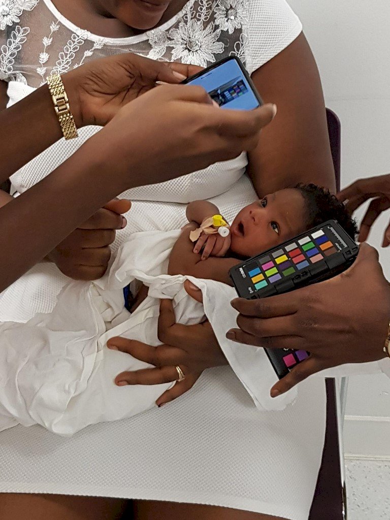 寶寶福音 手機app可偵測新生兒黃疸