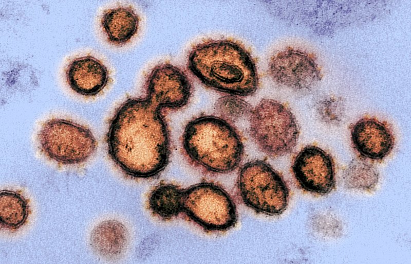 法諾貝爾得主稱病毒出自實驗室 再掀疫情論戰