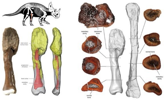 恐龍罹癌首例 腿骨化石畸形證實為惡性腫瘤