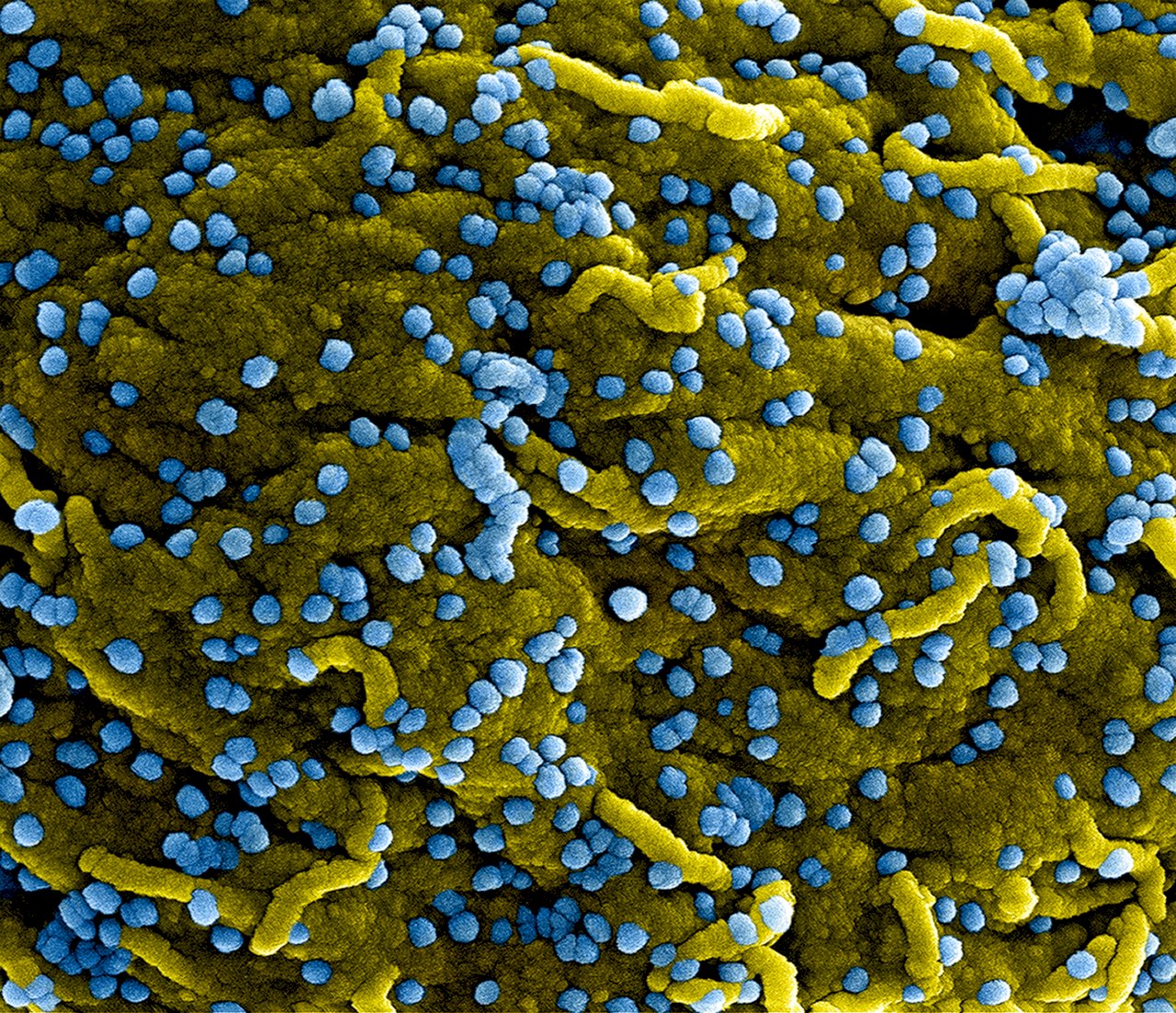 和伊波拉同樣致命 迦納首度發現馬堡病毒病例