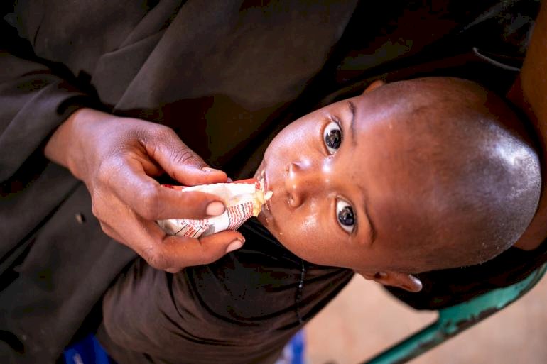 聯合國：50萬索馬利亞兒童 面臨本世紀最嚴重饑荒