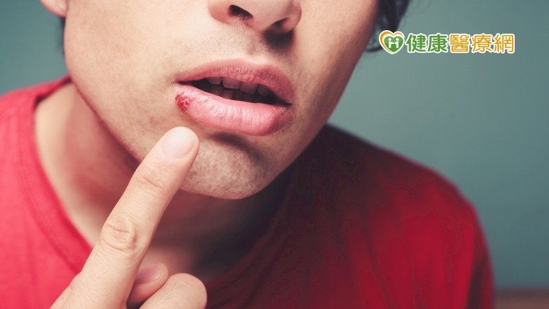 男子嘴巴破皮1年　就醫檢查驚罹口腔癌