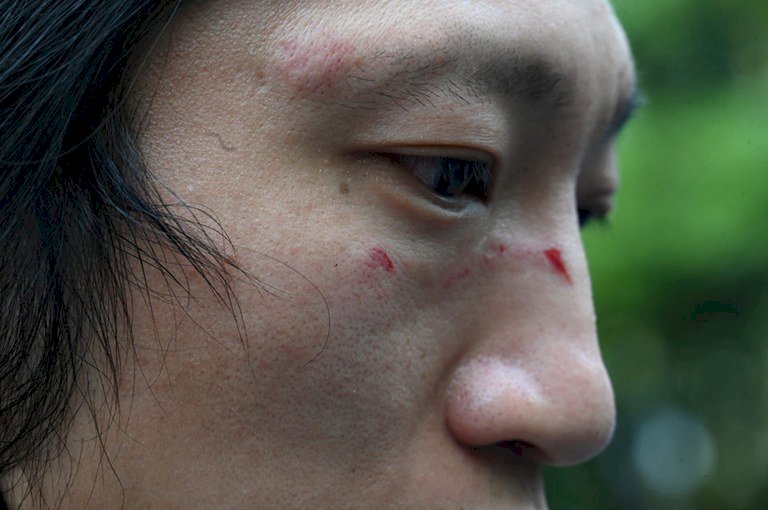 中國駐英外交官毆打示威者 傷者痛斥太野蠻
