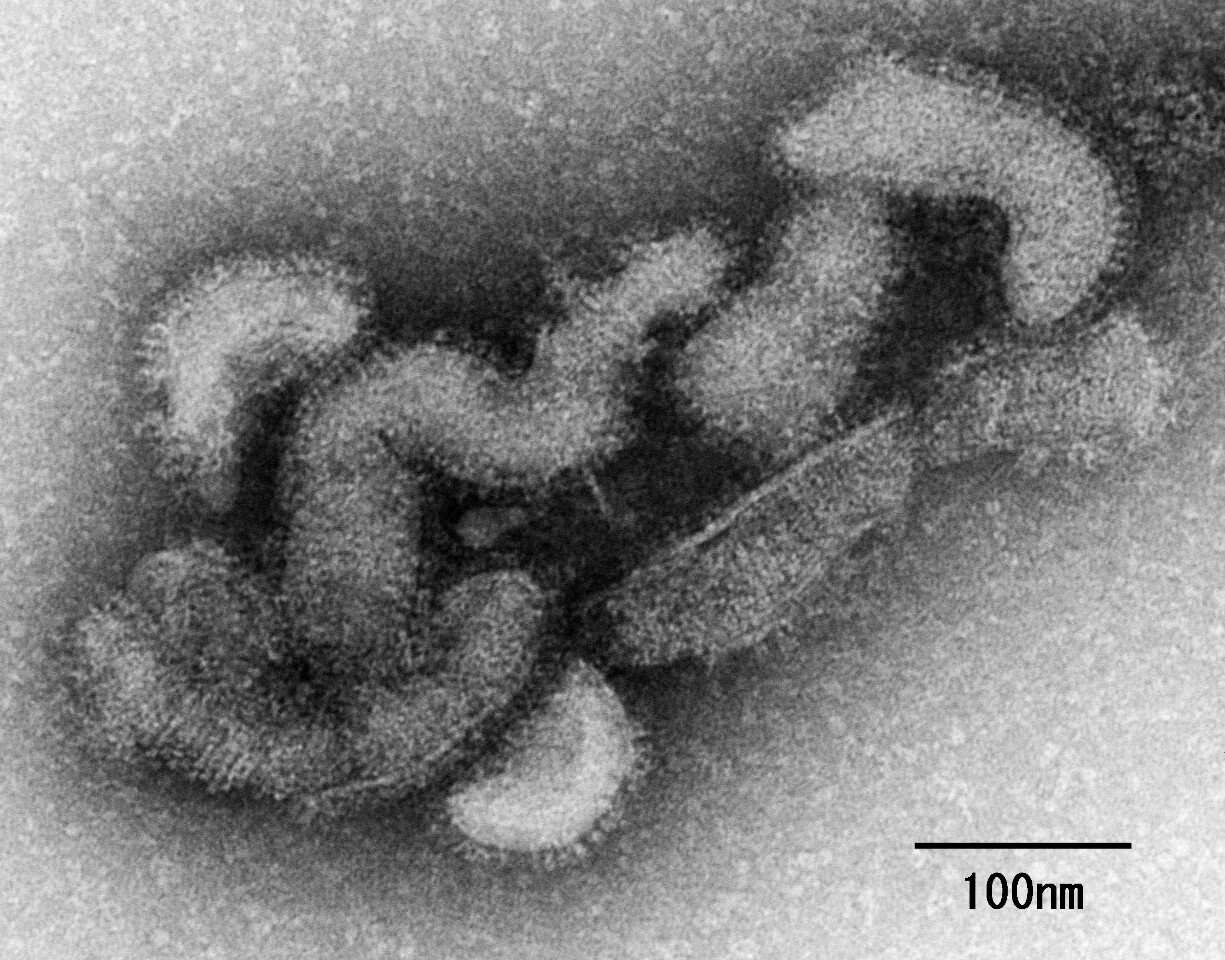 全球首例！遭蜱蟲咬後染「Oz病毒」 日本7旬婦病逝