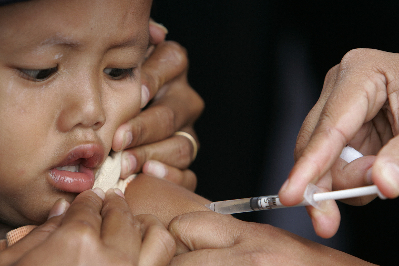 全球麻疹病例飆升 貧窮國家兒童面臨最大風險
